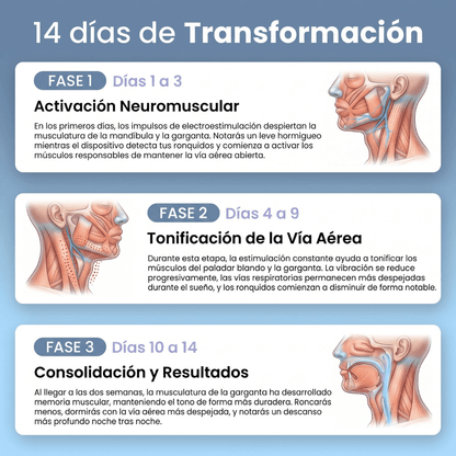 Dispositivo Inteligente Anti-Ronquidos